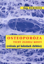 kniha Osteoporóza