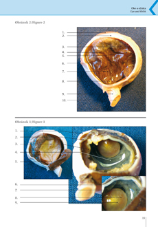 Topografická anatómia ťažko prístupných a klinicky významných oblastí hlavy - oko